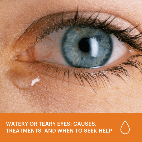 Watery or Teary Eyes: Causes, Treatments, & When to Seek Help - Kodak ...
